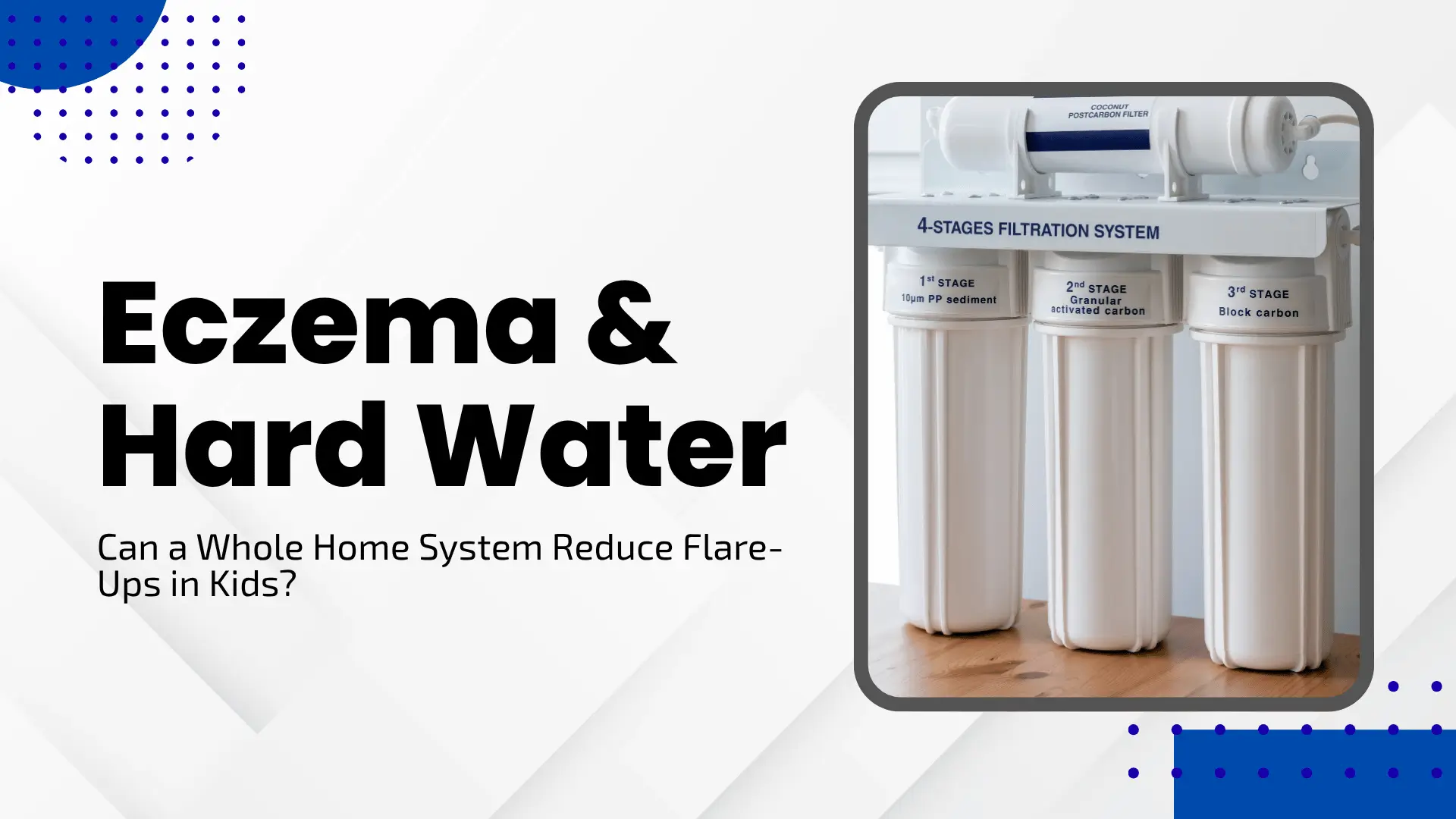 A 4-stage whole-home water filtration system with three vertical white canisters and a horizontal post-carbon filter on top, set against a modern white and blue geometric background. Bold black text reads "Eczema & Hard Water: Can a Whole Home System Reduce Flare-Ups in Kids?"